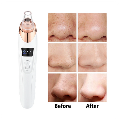 Deep Pore Cleaner Vacuum